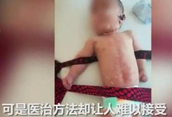 针灸疼痛视频,视频解析与疗效揭秘